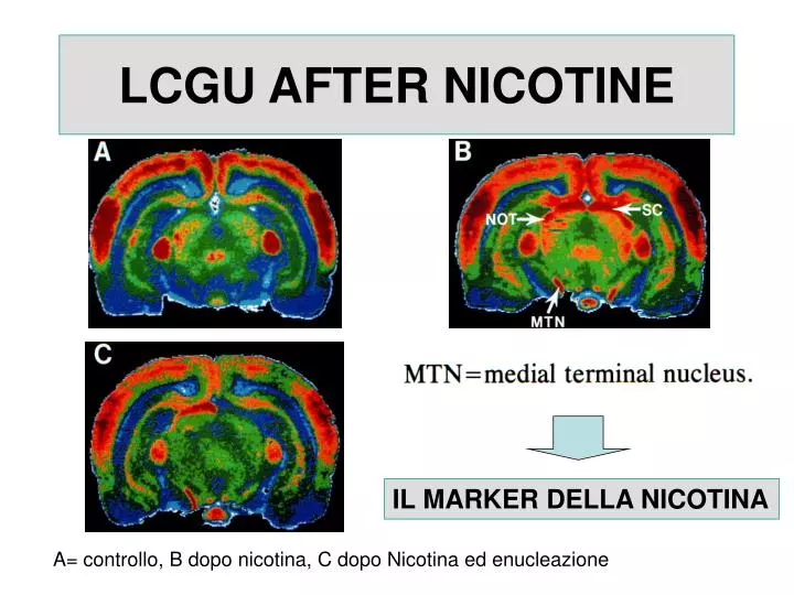 lcgu after nicotine