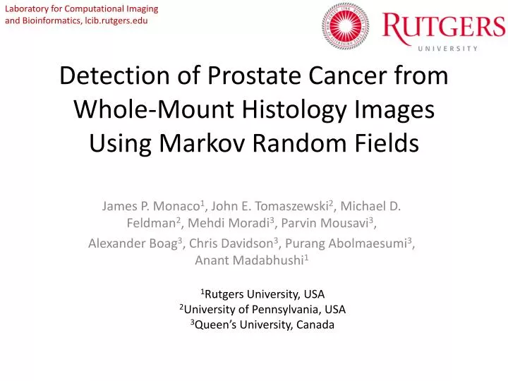 detection of prostate cancer from whole mount histology images using markov random fields