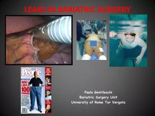 LEAKS IN BARIATRIC SURGERY
