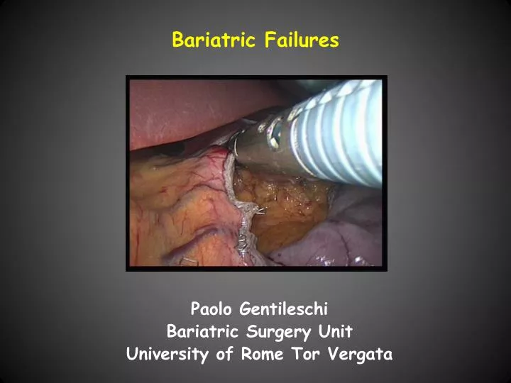bariatric failures