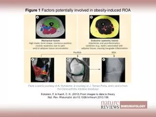 Figure 1 Factors potentially involved in obesity-induced ROA
