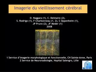 imagerie du vieillissement c r bral
