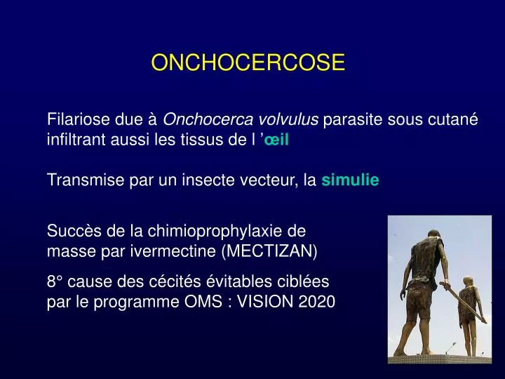 onchocercose