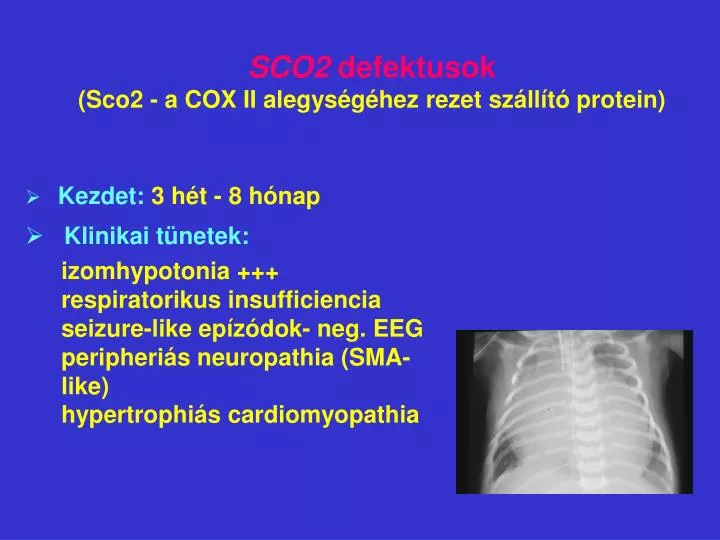 sco2 defektusok sco2 a cox ii alegys g hez rezet sz ll t protein