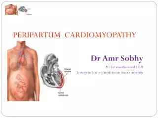 PERIPARTUM CARDIOMYOPATHY Dr Amr Sobhy M.D in anaesthesia and I.C.U
