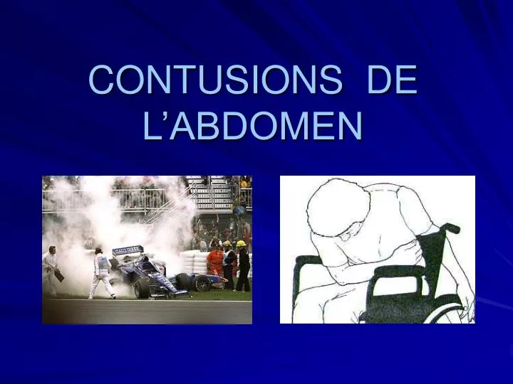 contusions de l abdomen