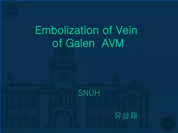 embolization of vein of galen avm