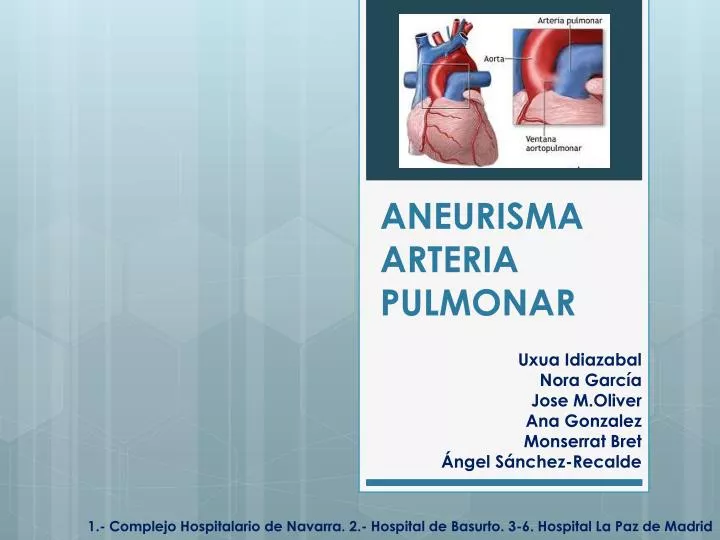 aneurisma arteria pulmonar