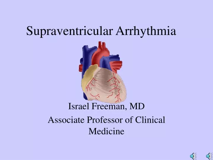 supraventricular arrhythmia