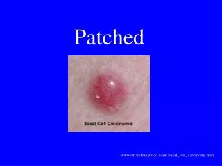 Patched