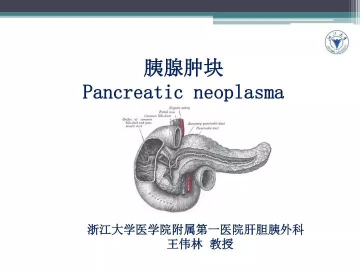 pancreatic neoplasma