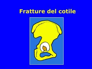fratture del cotile