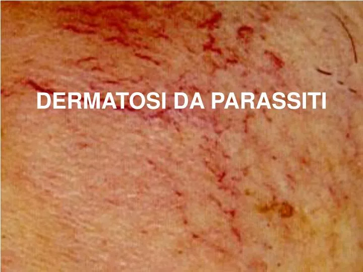 dermatosi da parassiti