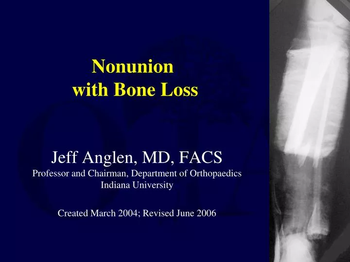nonunion with bone loss