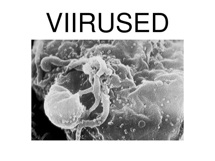 viirused