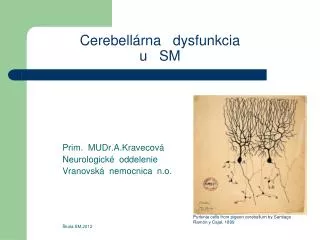 cerebell rna dysfunkcia u sm