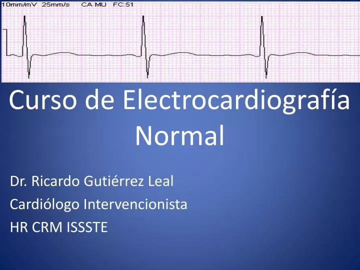 curso de electrocardiograf a normal