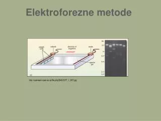 elektroforezne metode