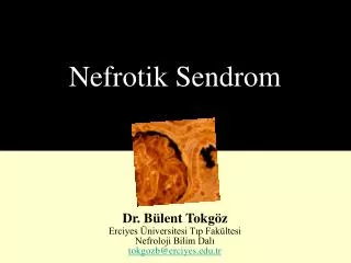 nefrotik sendrom