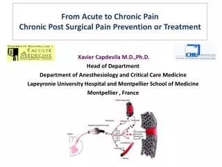 From Acute to Chronic Pain Chronic Post Surgical Pain Prevention or Treatment