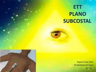 ett plano subcostal