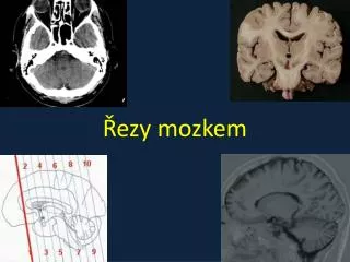ezy mozkem