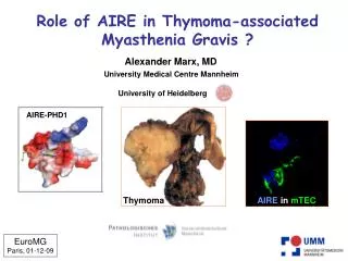 Role of AIRE in Thymoma-associated Myasthenia Gravis ?