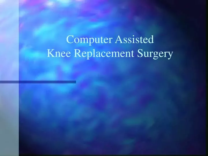 computer assisted knee replacement surgery