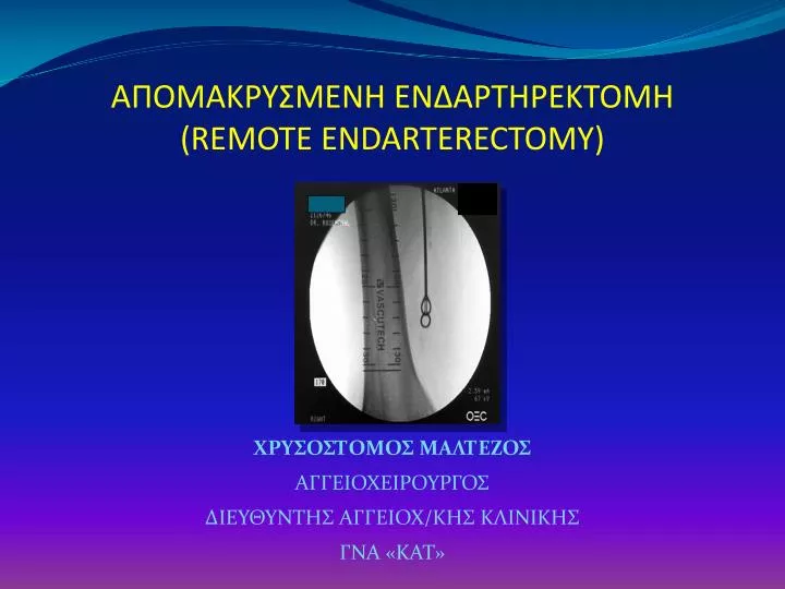 remote endarterectomy