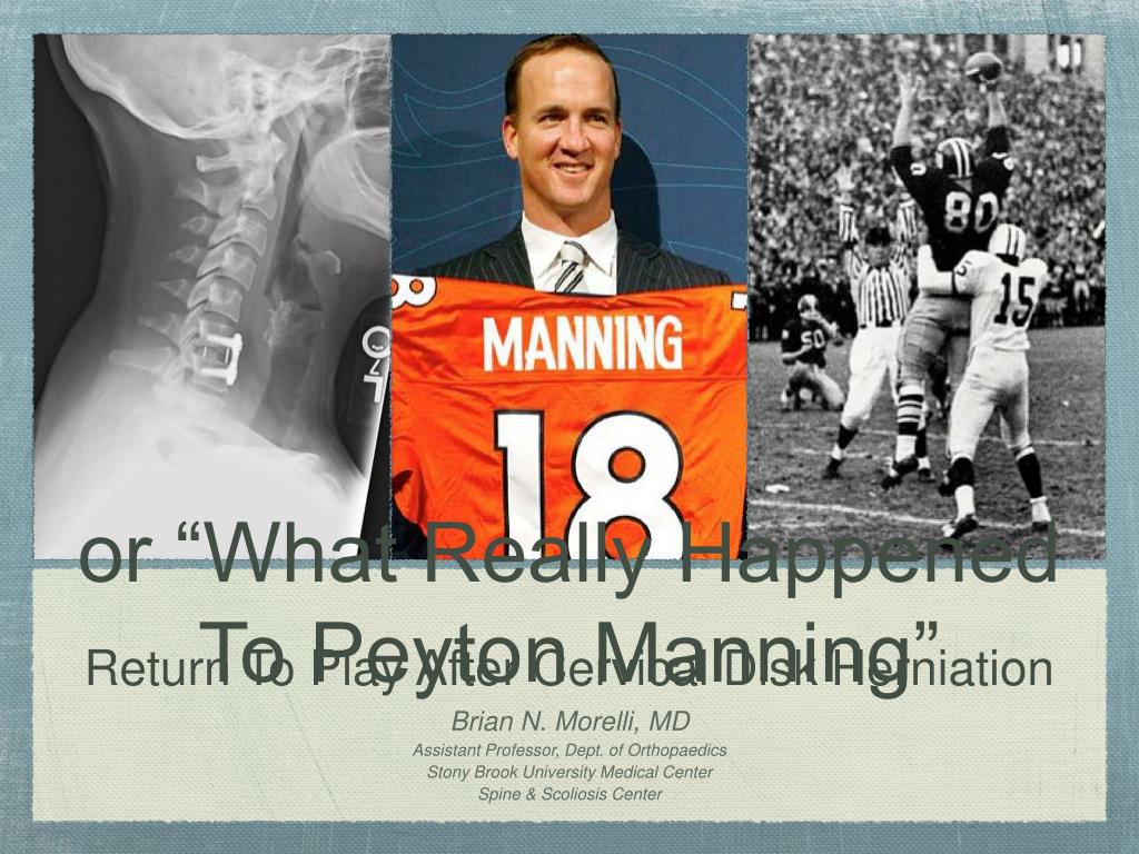 PPT - Return To Play After Cervical Disk Herniation PowerPoint ...