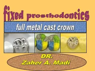 fixed prosthodontics