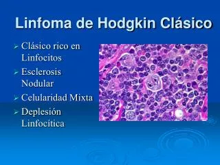 linfoma de hodgkin cl sico