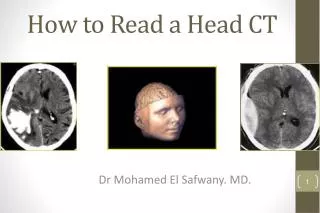 How to Read a Head CT