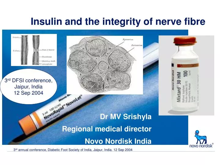 insulin and the integrity of nerve fibre