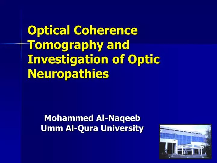 optical coherence tomography and investigation of optic neuropathies