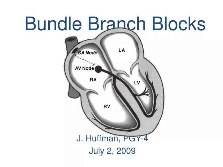 bundle branch blocks