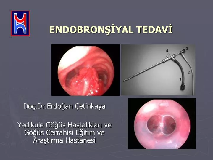 endobron yal tedav