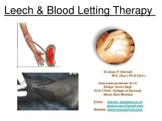 Leech &amp; Blood Letting Therapy