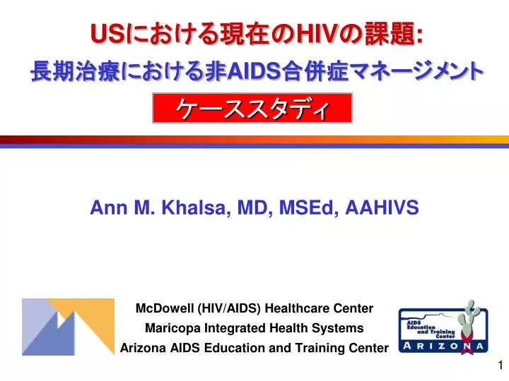 us hiv aids