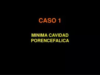 caso 1