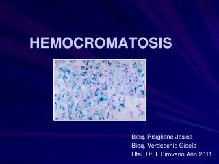 hemocromatosis