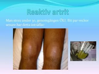reaktiv artrit