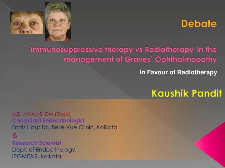 debate immunosuppressive therapy vs radiotherapy in the management of graves ophthalmopathy