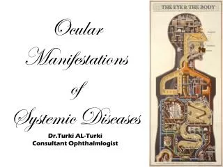 Ocular Manifestations of Systemic Diseases Dr.Turki AL- Turki Consultant Ophthalmlogist