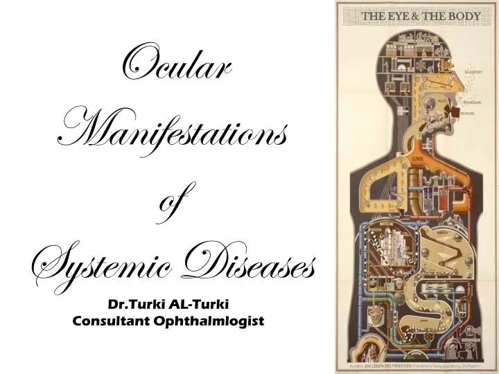 ocular manifestations of systemic diseases dr turki al turki consultant ophthalmlogist