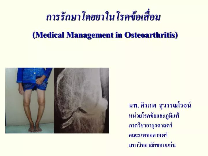 medical management in osteoarthritis