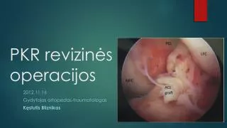 pkr revizin s operacijos