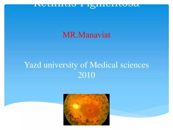 retinitis pigmentosa mr manaviat yazd university of medical sciences 2010