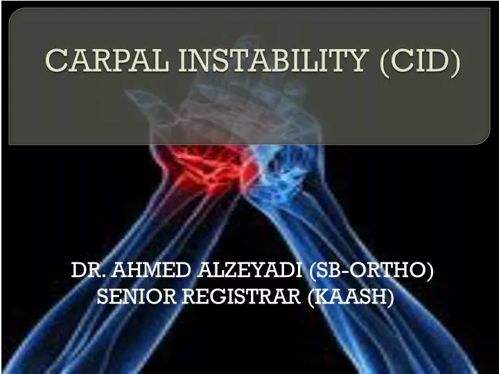 carpal instability cid