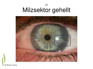 cli milzsektor gehellt